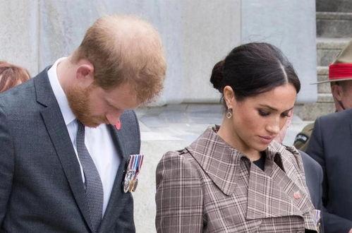 秃顶吃瓜,揭秘娱乐圈的“头顶秘密”